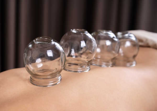 cupping celulitis